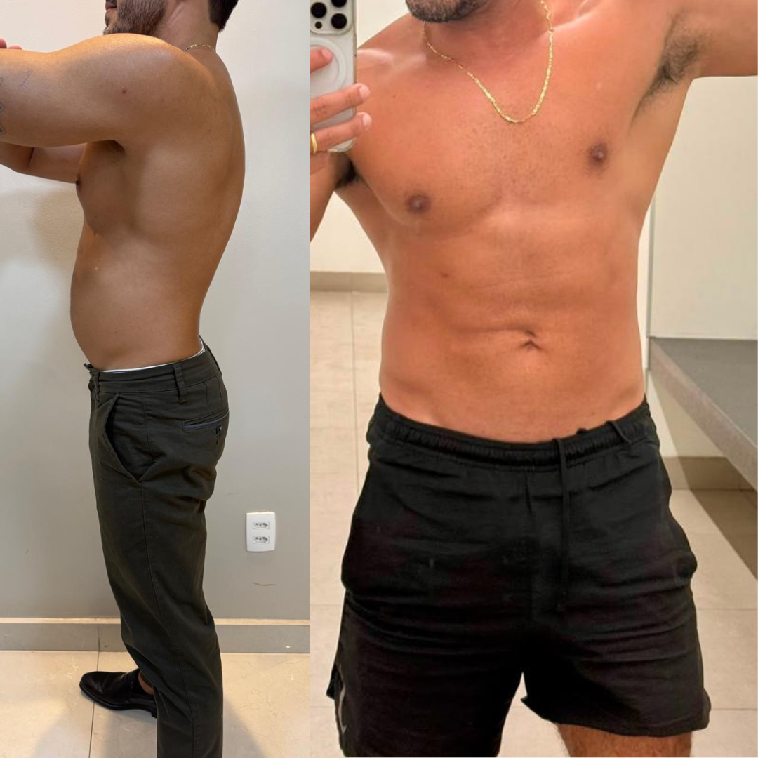 Tratamento masculino 1