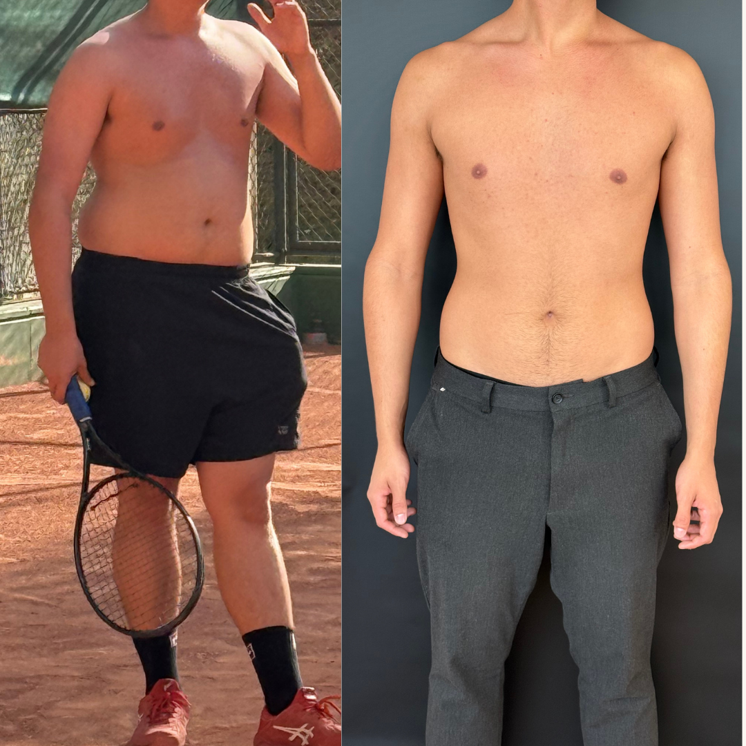 Tratamento masculino 2